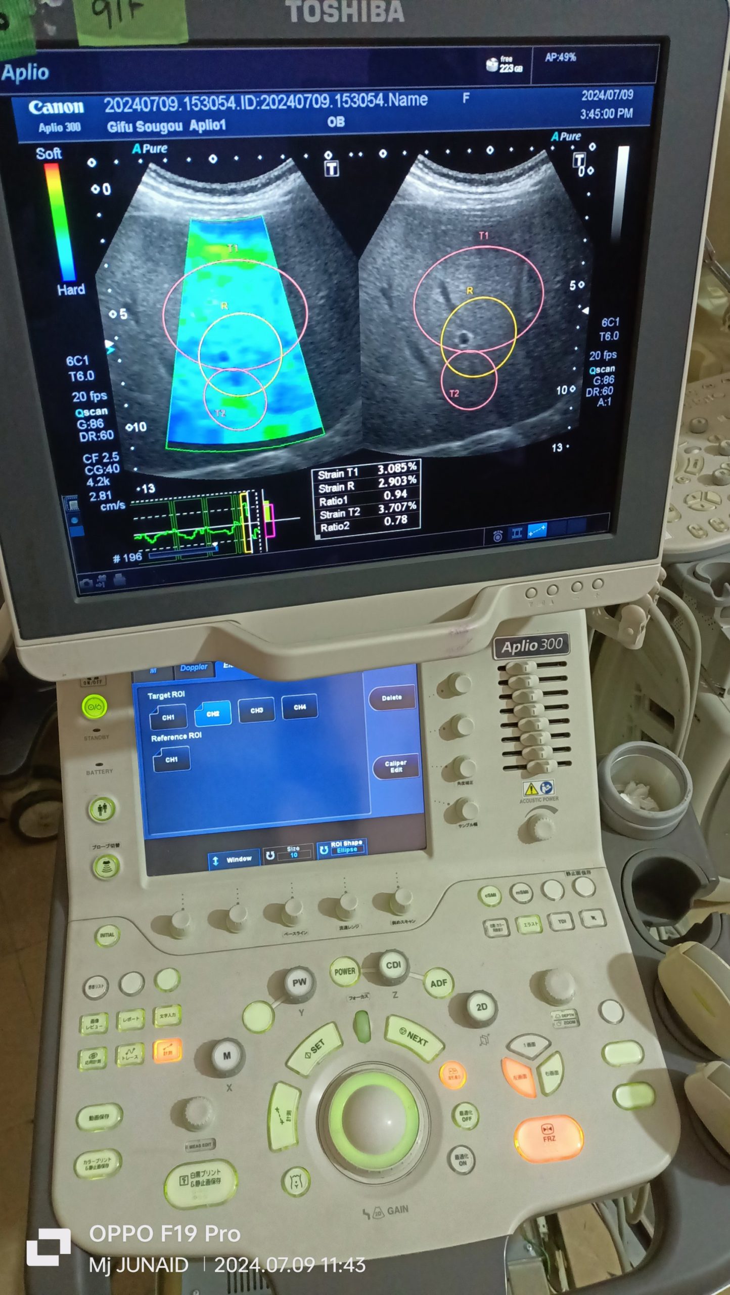 Toshiba Aplio 300 Platinum